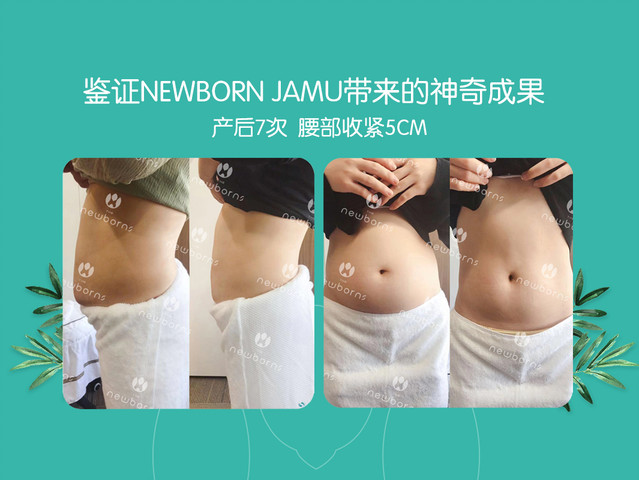 产后腹直肌修复,产后瘦肚子 (6).jpg